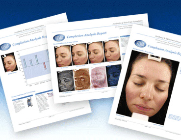 free skin analysis pickering